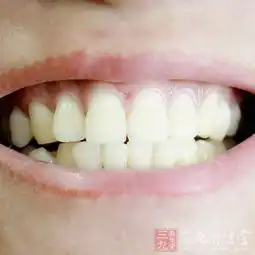 牙疼时这样做可快速缓解